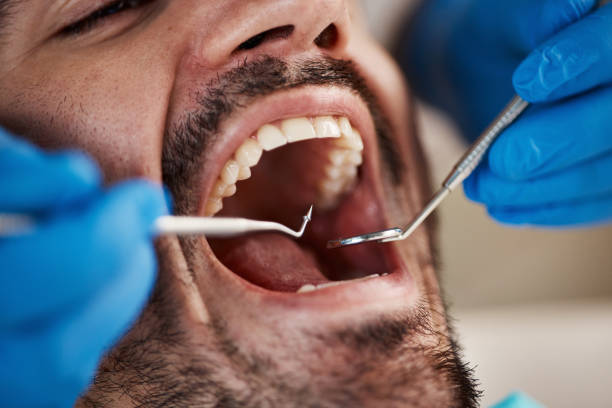 Fast & Reliable Emergency Dental Services in GA